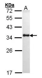 Anti-HLA-DRA antibody used in Western Blot (WB). GTX101865