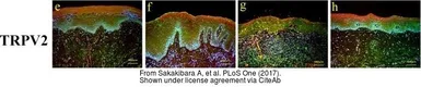 Anti-VRL1 antibody [C2C3], C-term used in IHC (Paraffin sections) (IHC-P). GTX101868