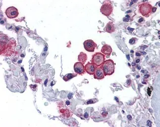 Anti-VRL1 antibody [C2C3], C-term used in IHC (Paraffin sections) (IHC-P). GTX101868