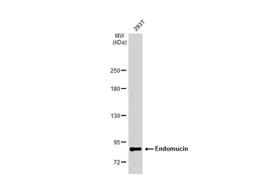 Anti-Endomucin antibody [N1C2] used in Western Blot (WB). GTX101871