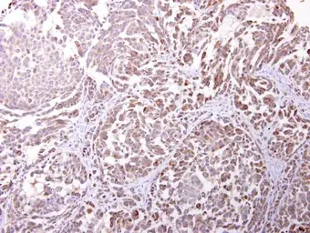 Anti-Endomucin antibody [N1C2] used in IHC (Paraffin sections) (IHC-P). GTX101871