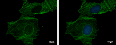 Anti-alpha Cardiac Muscle Actin antibody used in Immunocytochemistry/ Immunofluorescence (ICC/IF). GTX101876