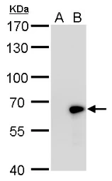 Anti-GAD67 antibody used in Western Blot (WB). GTX101881