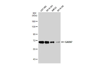 Anti-GAD67 antibody used in Western Blot (WB). GTX101881