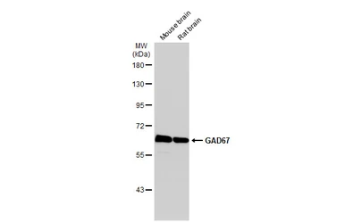 Anti-GAD67 antibody used in Western Blot (WB). GTX101881