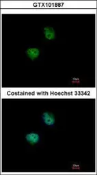 Anti-p70 S6K beta antibody used in Immunocytochemistry/ Immunofluorescence (ICC/IF). GTX101887