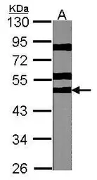 Anti-p70 S6K beta antibody used in Western Blot (WB). GTX101887