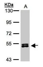 Anti-p70 S6K beta antibody used in Western Blot (WB). GTX101887