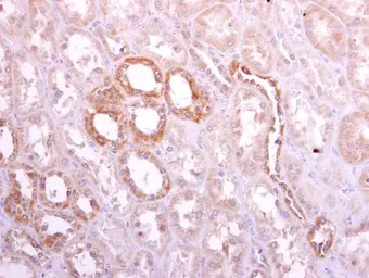 Anti-Ribophorin I antibody [C2C3], C-term used in IHC (Paraffin sections) (IHC-P). GTX101888