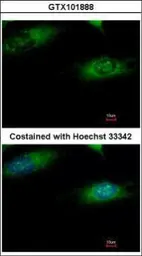 Anti-Ribophorin I antibody [C2C3], C-term used in Immunocytochemistry/ Immunofluorescence (ICC/IF). GTX101888