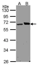 Anti-Ribophorin I antibody [C2C3], C-term used in Western Blot (WB). GTX101888