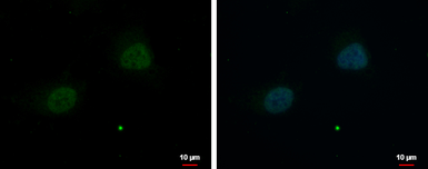 Anti-ZNF384 antibody [N1N2], N-term used in Immunocytochemistry/ Immunofluorescence (ICC/IF). GTX101975