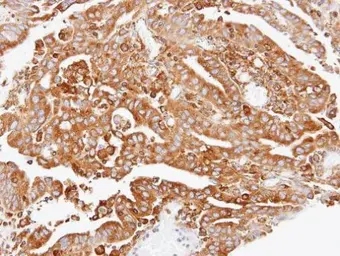 Anti-ARPC2 antibody used in IHC (Paraffin sections) (IHC-P). GTX101984