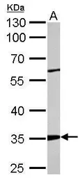 Anti-ARPC2 antibody used in Western Blot (WB). GTX101984