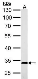 Anti-ARPC2 antibody used in Western Blot (WB). GTX101984