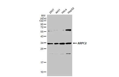 Anti-ARPC2 antibody used in Western Blot (WB). GTX101984