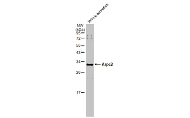 Anti-ARPC2 antibody used in Western Blot (WB). GTX101984