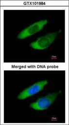 Anti-ARPC2 antibody used in Immunocytochemistry/ Immunofluorescence (ICC/IF). GTX101984