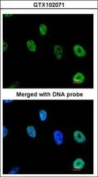 Anti-TAP antibody [N1N2], N-term used in Immunocytochemistry/ Immunofluorescence (ICC/IF). GTX102071