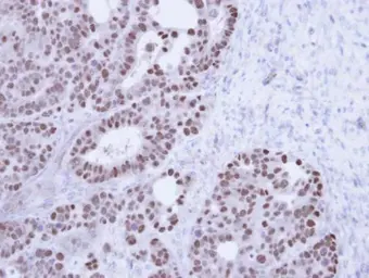 Anti-TAP antibody [N1N2], N-term used in IHC (Paraffin sections) (IHC-P). GTX102071
