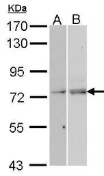 Anti-TAP antibody [N1N2], N-term used in Western Blot (WB). GTX102071