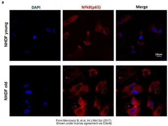 Anti-NFkB p65 antibody used in Immunocytochemistry/ Immunofluorescence (ICC/IF). GTX102090