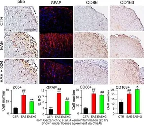 Anti-NFkB p65 antibody used in IHC (Paraffin sections) (IHC-P). GTX102090