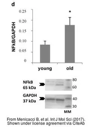 Anti-NFkB p65 antibody used in Western Blot (WB). GTX102090