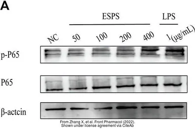 Anti-NFkB p65 antibody used in Western Blot (WB). GTX102090