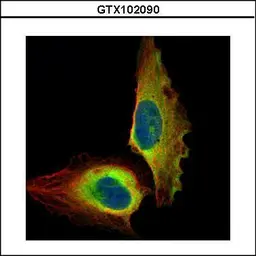 Anti-NFkB p65 antibody used in Immunocytochemistry/ Immunofluorescence (ICC/IF). GTX102090