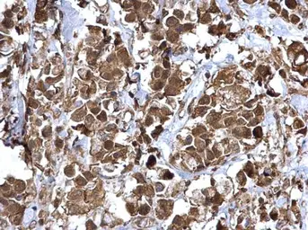 Anti-NFkB p65 antibody used in IHC (Paraffin sections) (IHC-P). GTX102090