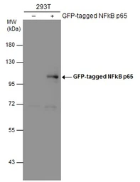 Anti-NFkB p65 antibody used in Western Blot (WB). GTX102090