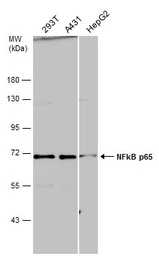 Anti-NFkB p65 antibody used in Western Blot (WB). GTX102090