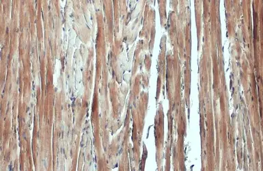 Anti-NFkB p65 antibody used in IHC (Paraffin sections) (IHC-P). GTX102090