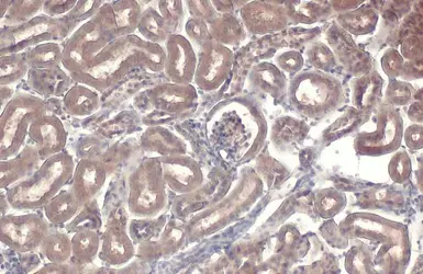 Anti-NFkB p65 antibody used in IHC (Paraffin sections) (IHC-P). GTX102090