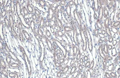 Anti-NFkB p65 antibody used in IHC (Paraffin sections) (IHC-P). GTX102090