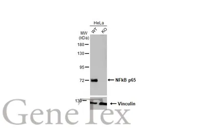 Anti-NFkB p65 antibody used in Western Blot (WB). GTX102090