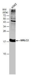 Anti-MRLC2 antibody used in Western Blot (WB). GTX102091