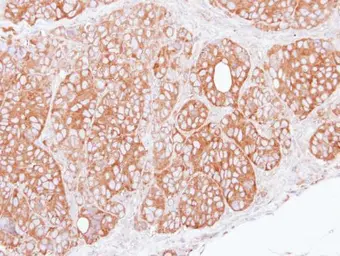 Anti-TRIM27 antibody used in IHC (Paraffin sections) (IHC-P). GTX102098