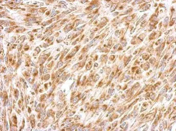 Anti-Prohibitin 2 antibody used in IHC (Paraffin sections) (IHC-P). GTX102100