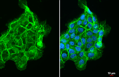 Anti-CD44 antibody used in Immunocytochemistry/ Immunofluorescence (ICC/IF). GTX102111