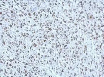 Anti-POM121 antibody [N2N3] used in IHC (Paraffin sections) (IHC-P). GTX102128