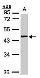 Anti-VPS72 antibody [N1C1] used in Western Blot (WB). GTX102152