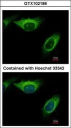 Anti-MEK2 antibody used in Immunocytochemistry/ Immunofluorescence (ICC/IF). GTX102186