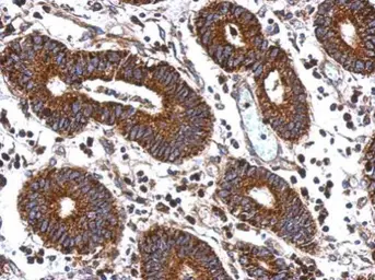 Anti-MEK2 antibody used in IHC (Paraffin sections) (IHC-P). GTX102186