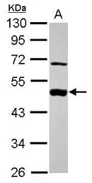 Anti-MEK2 antibody used in Western Blot (WB). GTX102186