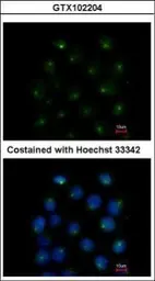 Anti-SAR1A antibody [N1C3] used in Immunocytochemistry/ Immunofluorescence (ICC/IF). GTX102204