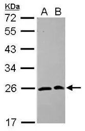 Anti-SAR1A antibody [N1C3] used in Western Blot (WB). GTX102204