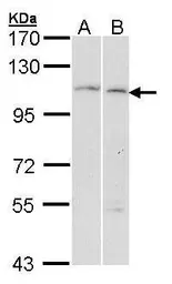 Anti-alpha Glucosidase II antibody [C2C3], C-term used in Western Blot (WB). GTX102205