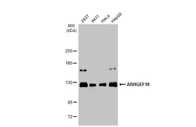 Anti-ARHGEF18 antibody used in Western Blot (WB). GTX102223